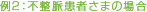 例2：不整脈患者さまの場合