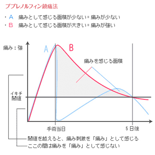 ブプレノルフィン鎮痛法
