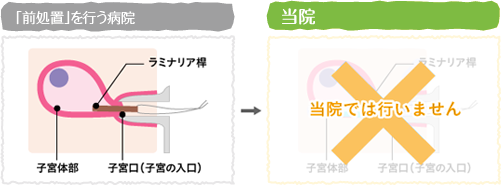前処置図