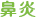 鼻炎