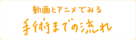 動画とアニメでみる、手術までの流れ