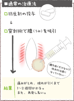 通常の治療法