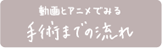 動画とアニメでみる手術までの流れ